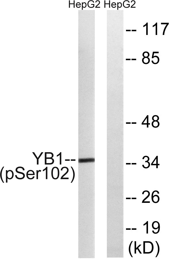 YB 1 phospho Ser102 Polyclonal Antibody ELISA科研检测中心 优品生物官网