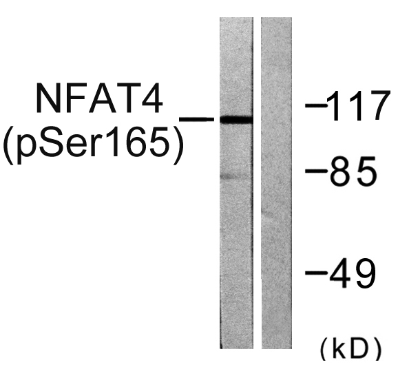 Nfatc Phospho Ser Polyclonal Antibody Elisa